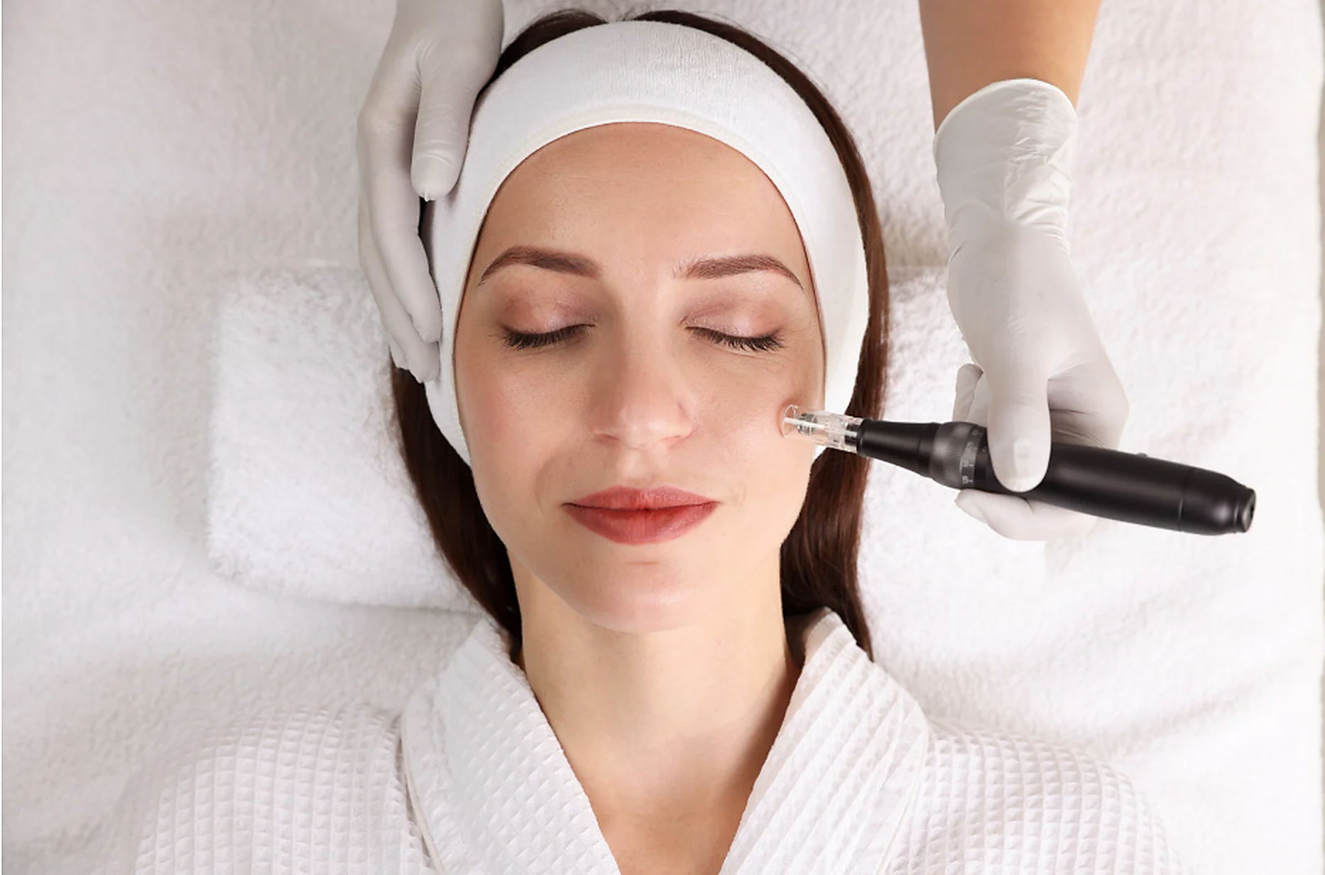 Microneedling